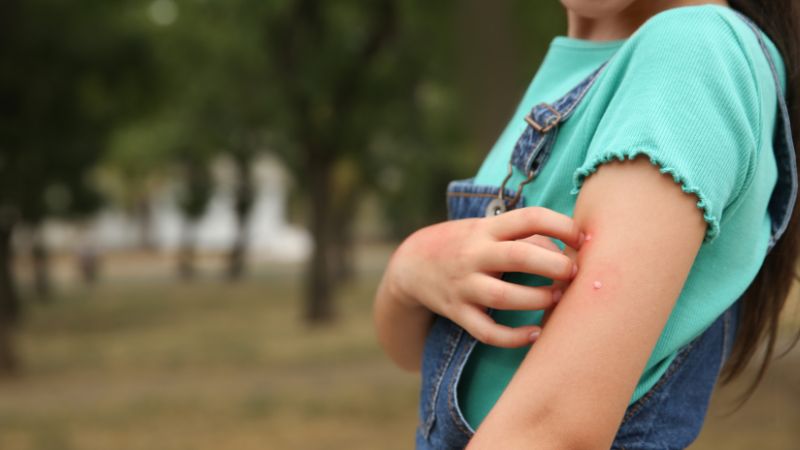 ugryzienia-pluskiew-u-dzieci