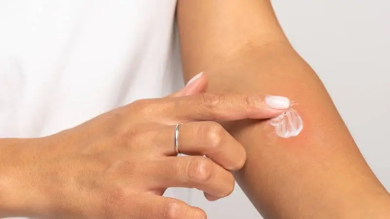 Read more about the article Czy karaluchy gryzą? Czy to ich ugryzienia swędzą?