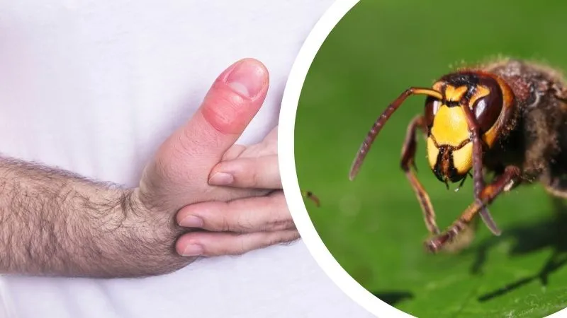 Read more about the article Użądlenie szerszenia — czy jest groźne? Jakie są objawy? Jak wygląda?