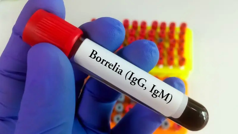 borelioza-choroba-od-kleszczy