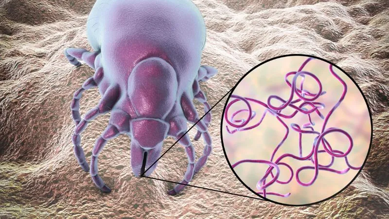 borelioza-choroba-odkleszczowa