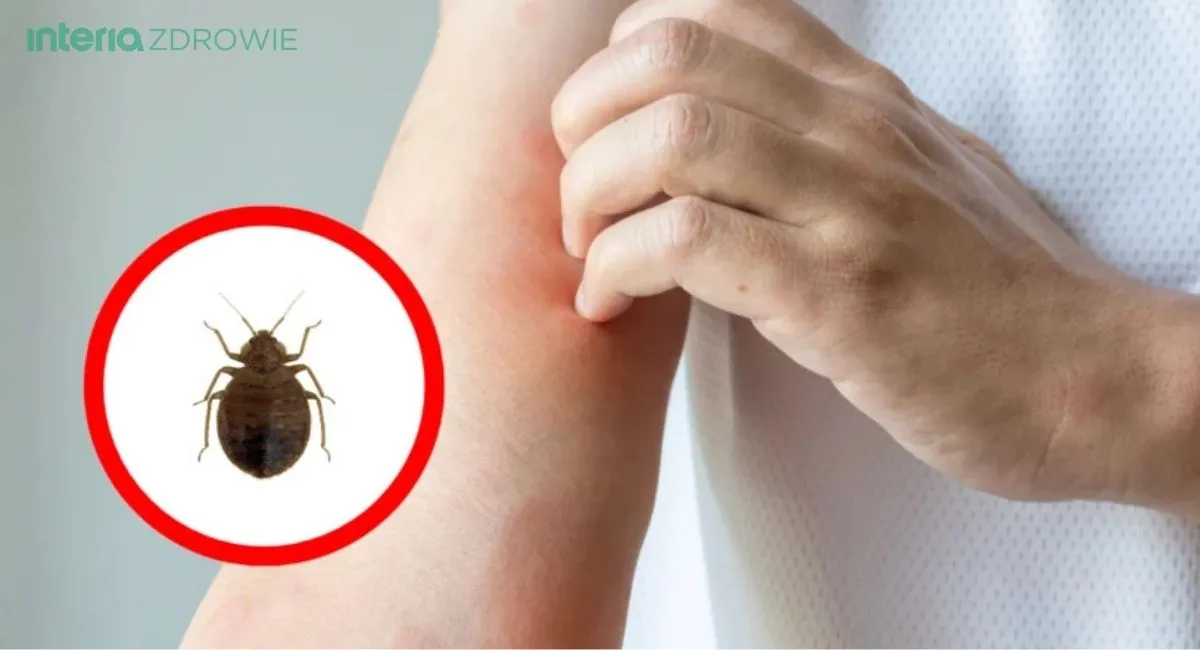 insektstop-na-interia